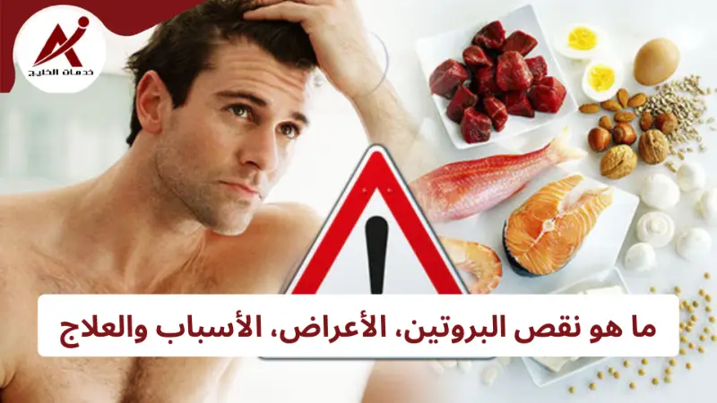 نقص البروتين، الأعراض والأسباب - كيف تحصل على حاجتك اليومية من البروتين